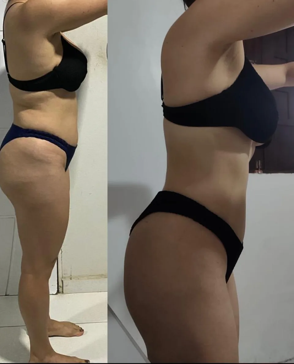 Antes e depois real de aluna do Desafio Destrava Hormonal, resultado 9