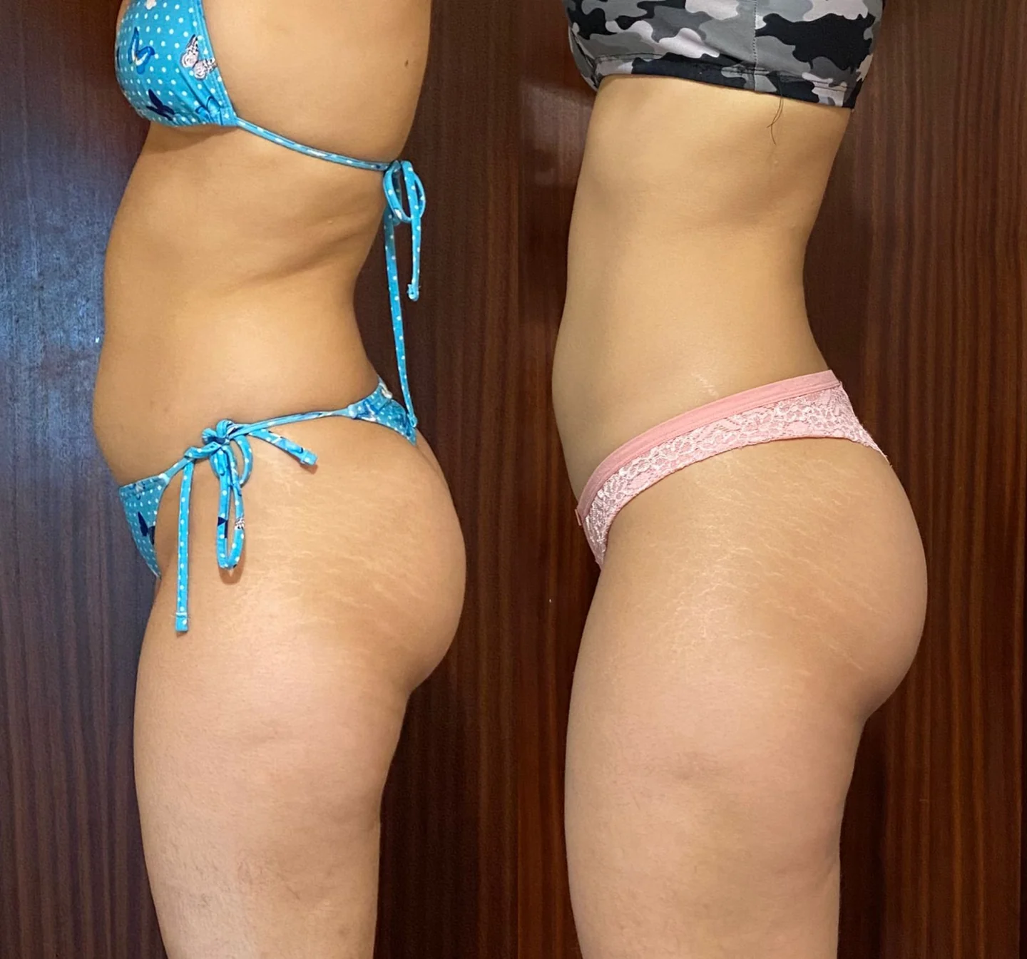 Antes e depois real de aluna da Consultoria Online HERO — resultado 8