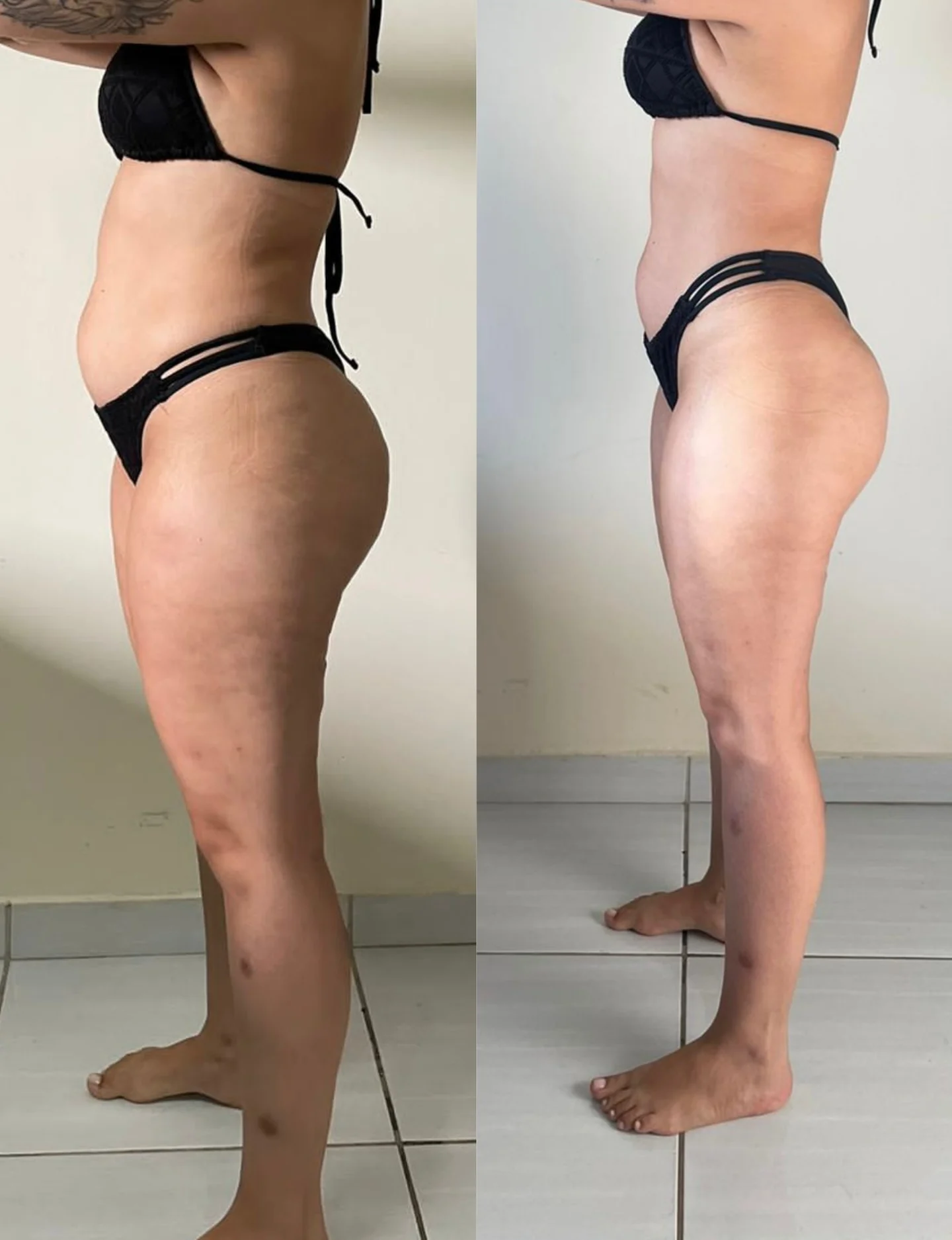 Antes e depois real de aluna da Consultoria Online HERO — resultado 6